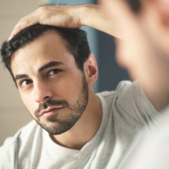 Man Losing Hair