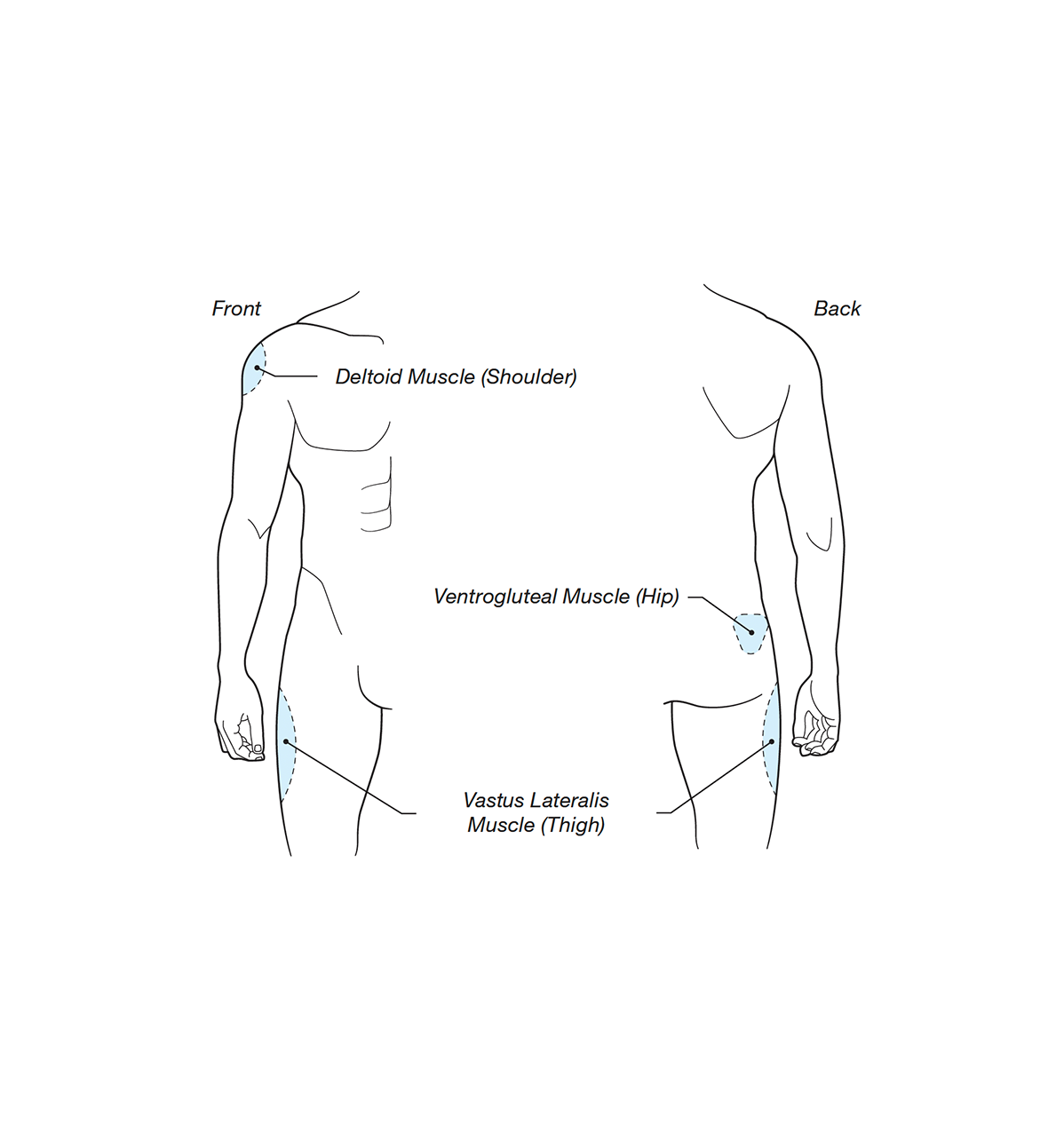 Intramuscular (IM) Injection Instructions | Empower Pharmacy