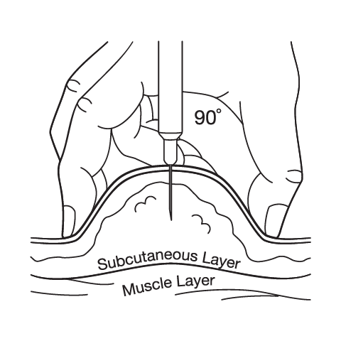 Subcutaneous Injection Instructions